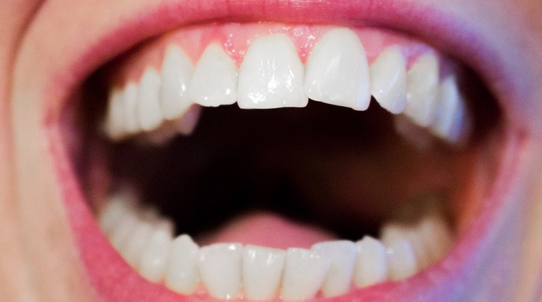 Ученые нашли древний метод профилактики лечения зубов