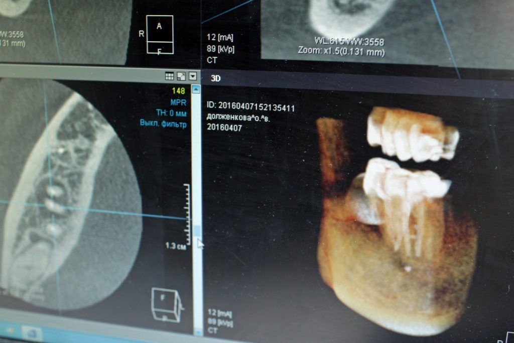 Стоматолог рассказала, какие проблемы с зубами возникают из-за стресса