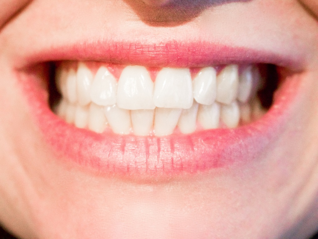 Стоматолог объяснила, почему зимой болят зубы