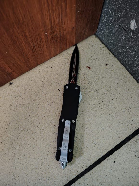 У бара на Ломоносова посетитель получил удар ножом и остался без Apple Watch